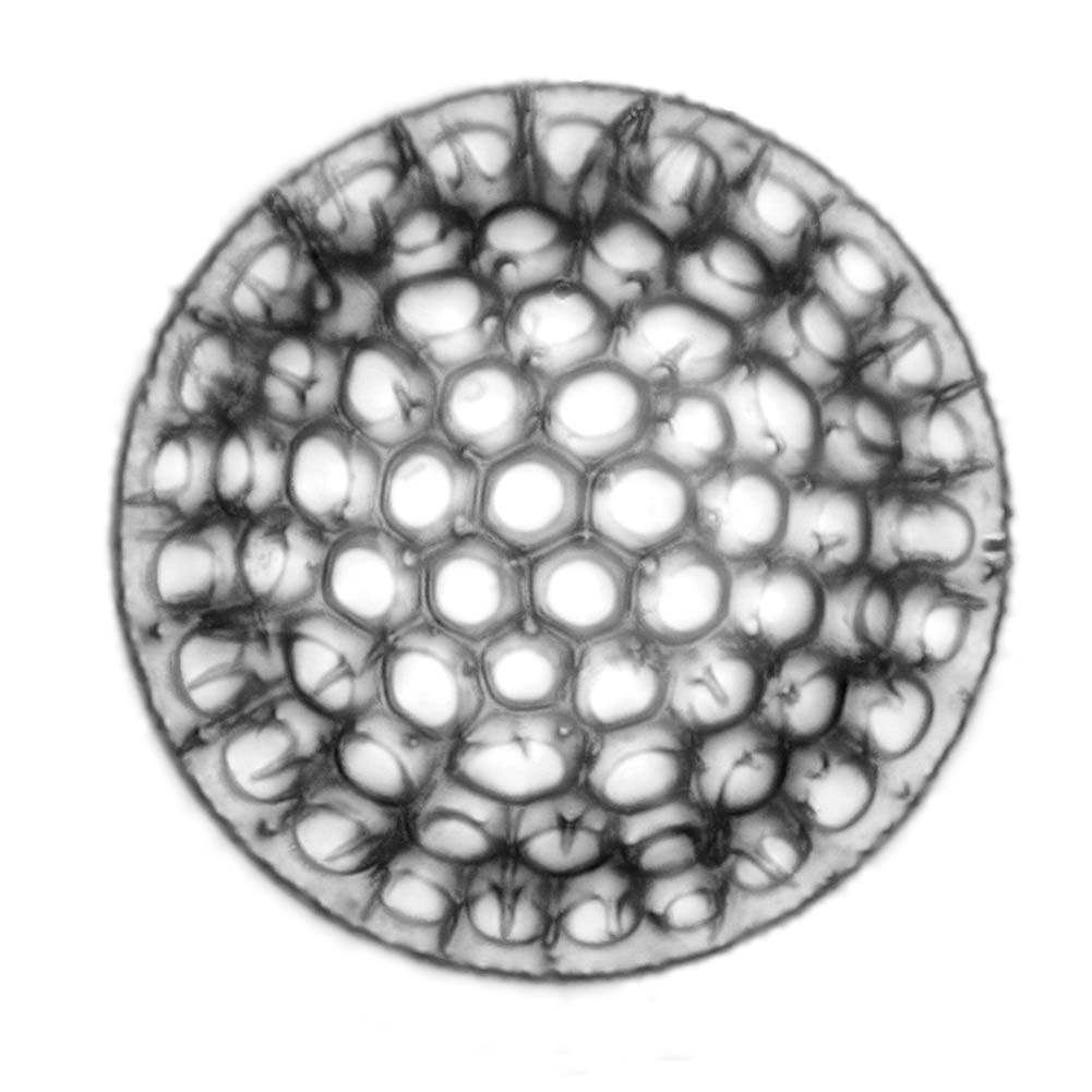 Diatomee_-_Diatom_(fossile)_-_Stephanopyxis_sp._-_630x_-_Top_view_(14117161278)